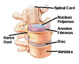 diagram of the inervertebral disc